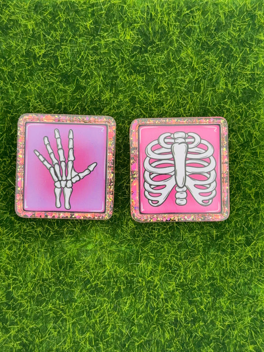 Skeletal X-Ray Markers